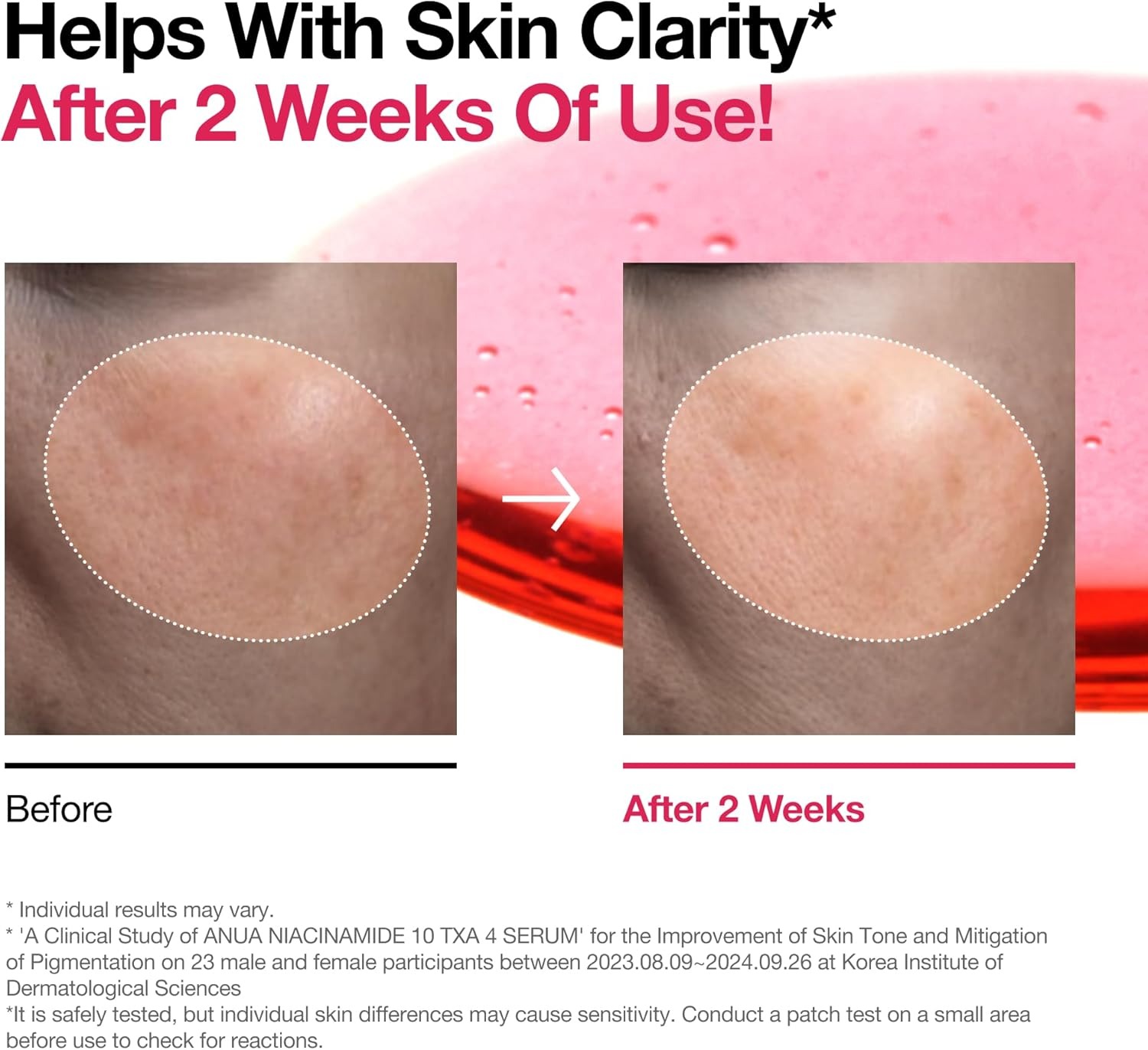 ANUA Suero con 10% de niacinamida y 4% de ácido tranexámico, ceramida, ácido hialurónico, vitamina B12, color natural, para pieles sensibles, piel de cristal coreana, sin fragancia 30 ml/1,01 fl.oz. - Image 5