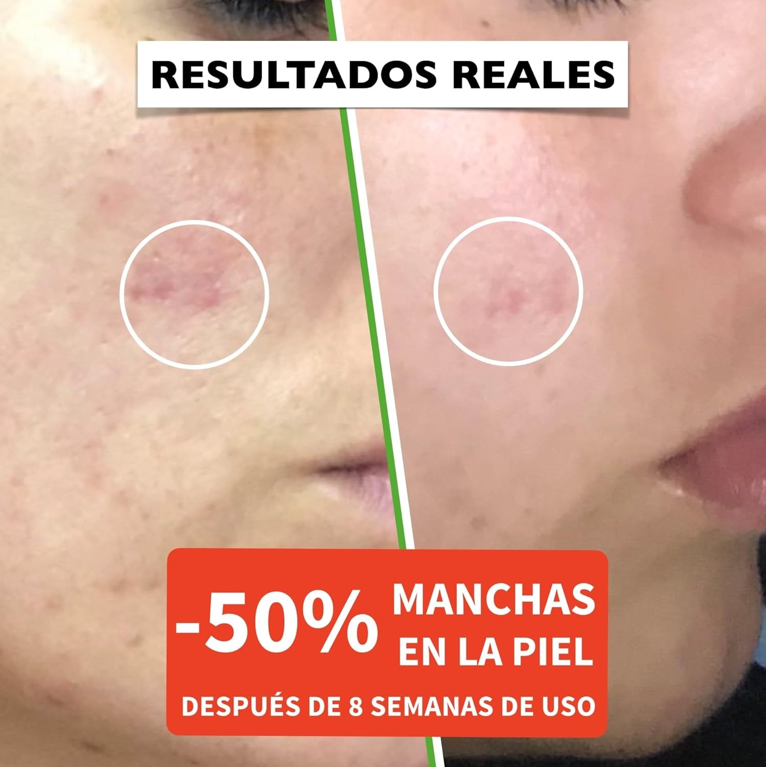 Descuento por primer pedido:Suero Facial Orgánico Vitamina C y Ácido Hialurónico Puro – Remueve Cicatrices de Acné, Manchas de Piel - Efecto Anti Edad - Sérum BIO - Antiarrugas Illuminante Natural Para Rostro y Cuello - 60ml - Image 3